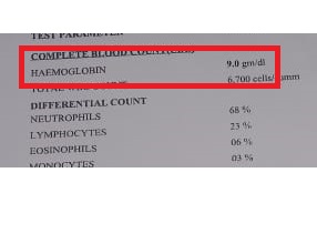 Anemia after treatment