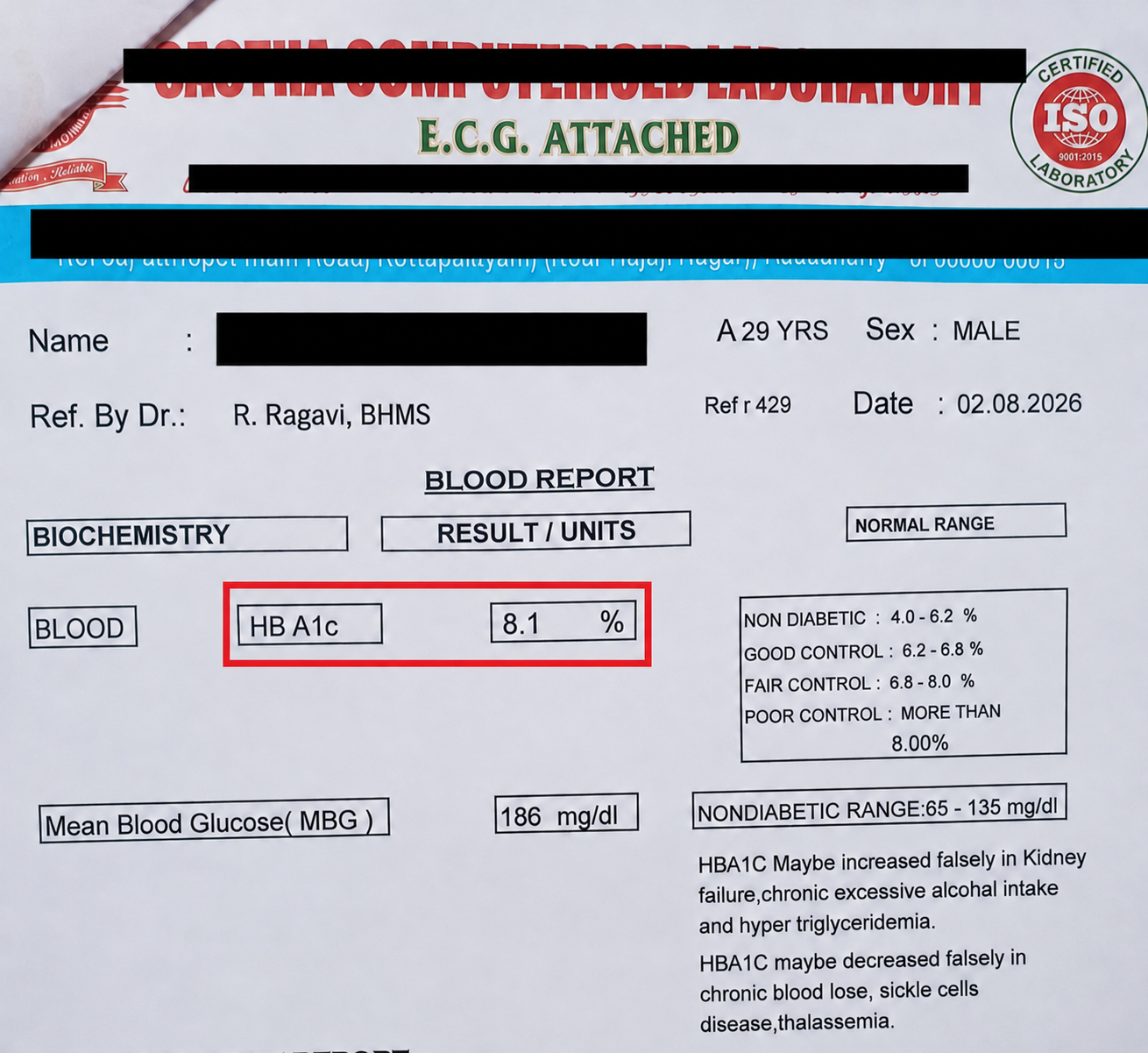 Diabetes after treatment